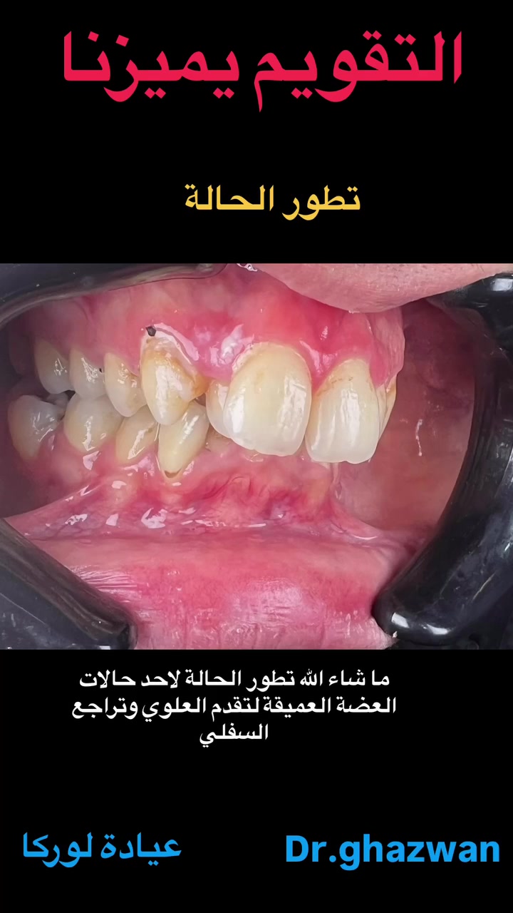 تقويم الأسنان والفكين • حالات معقدة • بغداد الكرخ