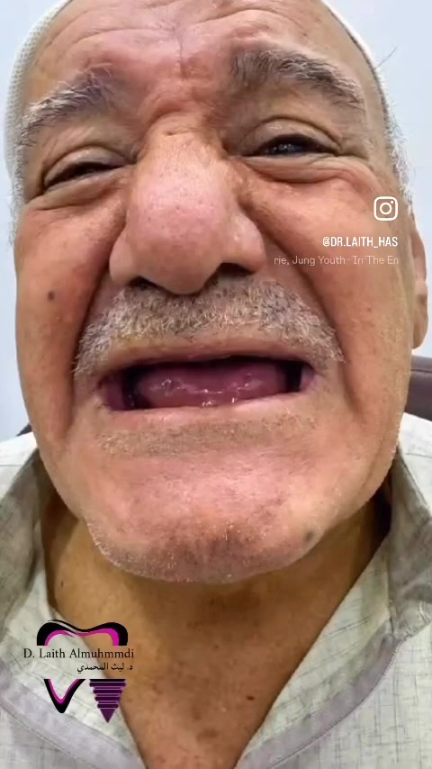 زراعة أسنان • الفلوجة الجغيفي • تقسيط