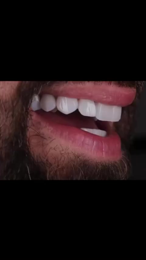 الأسنان التعبانة والمكسورة لها حل! بتغليف واحد مدروس،
 نرجع للسن قوته وشكله الأحلى.
 لا تتردد واستشرنا.🦷🤍👆🏼

البصرة المطيحة مجاور مدارس الفراهيدي ***********
