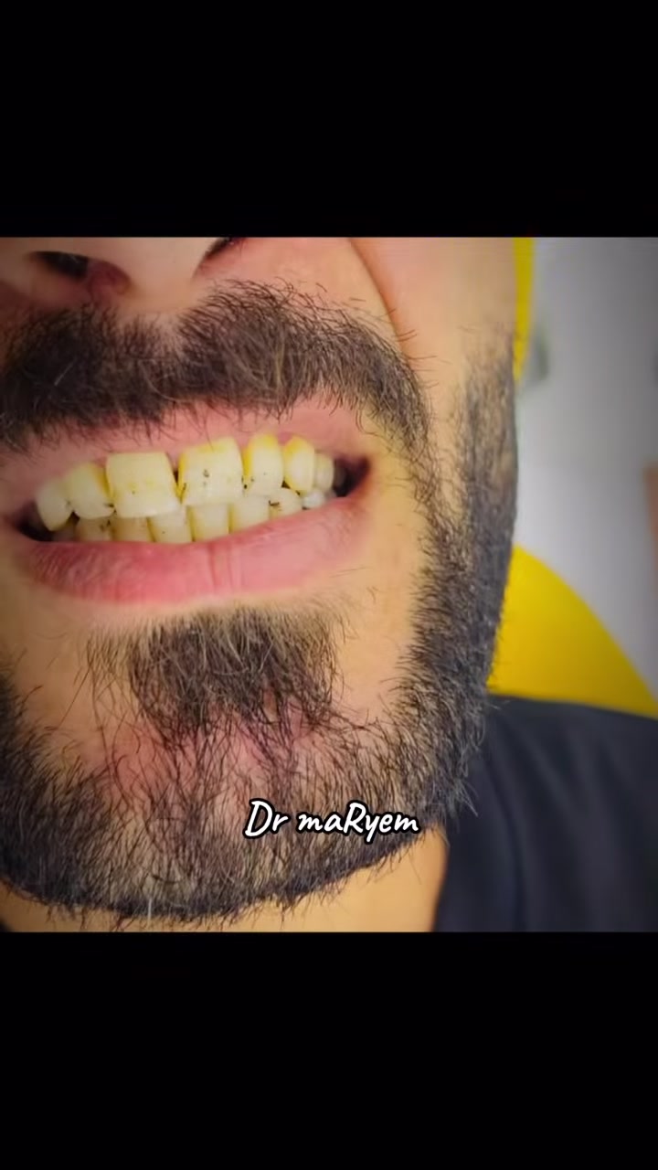 للحجز والاستفسار ***********
