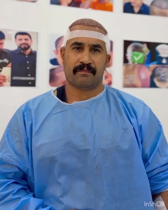 زراعة شعر • مخدّر سيداسيون • زيونة