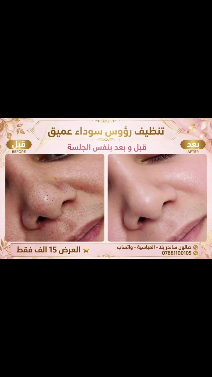 العباسية • صالون تجميل