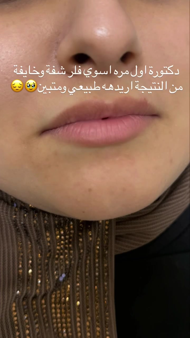 رڤيوات مراجعاتي الكيكات فرع بغداد وفرع المسيب
مراجعاتي فرع المسيب كلش حابين عروض فرحة الزهرة وموسم الاعراس 🍒💉 لواكدر ابقالكم اسبوع كامل حتى الكل يلحك ويكدر يسوي بس للاسف مااتواجد فقط ايام معينة بالمسيب ولهذا العروض على طلبكم موجودة 💗
💗💉

شنو رأيكم بالنتائج والجمال ✨ 

للاستفسار اكثر دايركت مسج انستكرام او فيسبوك https://www.instagram.com/p/DbWWdUhsNAt/?igsi=Z2EwenVjcm5rOXFu

DrRusl Alrubaie

والاستفسار عن العروض والحجز المسبق ومواعيد تواجدي داخل العياده التواصل يكون واتساب فقط مسجات ***********
