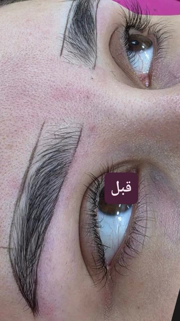 اليسا بيوتي • دهوك مالطا • تسريح ضمان سنة