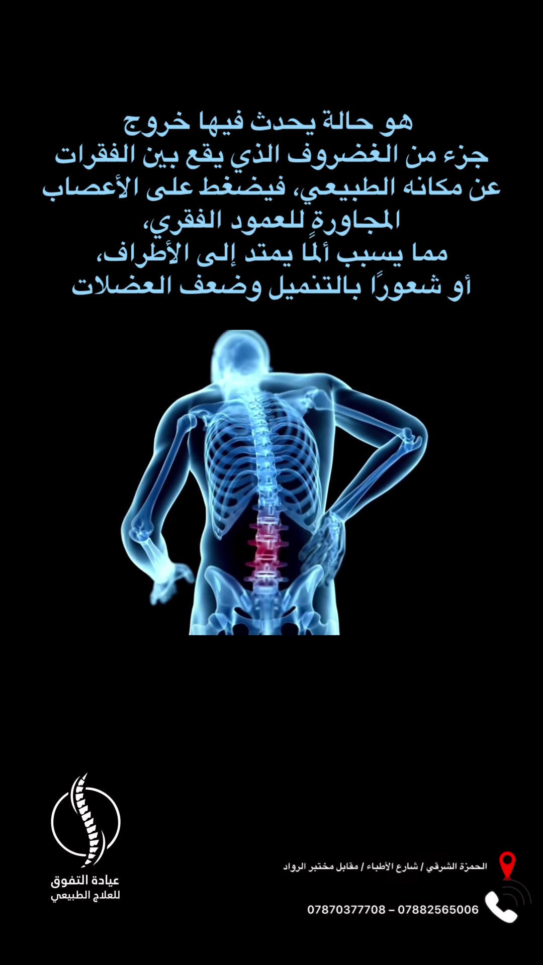 🩺 الانزلاق الغضروفي… ألم يمكن علاجه دون جراحة 🌿
يحدث عندما يخرج الغضروف من مكانه فيضغط على الأعصاب مسببًا ألماً وتنميلاً وصعوبة في الحركة.

💡 العلاج بجهاز سحب الفقرات يخفف الضغط عن الأعصاب، ويساعد الغضروف على العودة إلى وضعه الطبيعي تدريجيًا، فيمنحك راحة وحركة أفضل بدون أدوية ولا تدخل جراحي.

📍 عيادة التفوق للعلاج الطبيعي والتأهيل الطبي
📞 *********** – ***********
📌 الحمزة الشرقي – شارع الأطباء / مقابل مختبر الرواد
   #انزلاق_غضروفي
