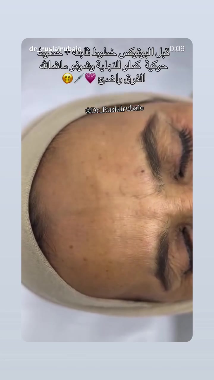 ابر النضارة • فلر شفايف • المسيب