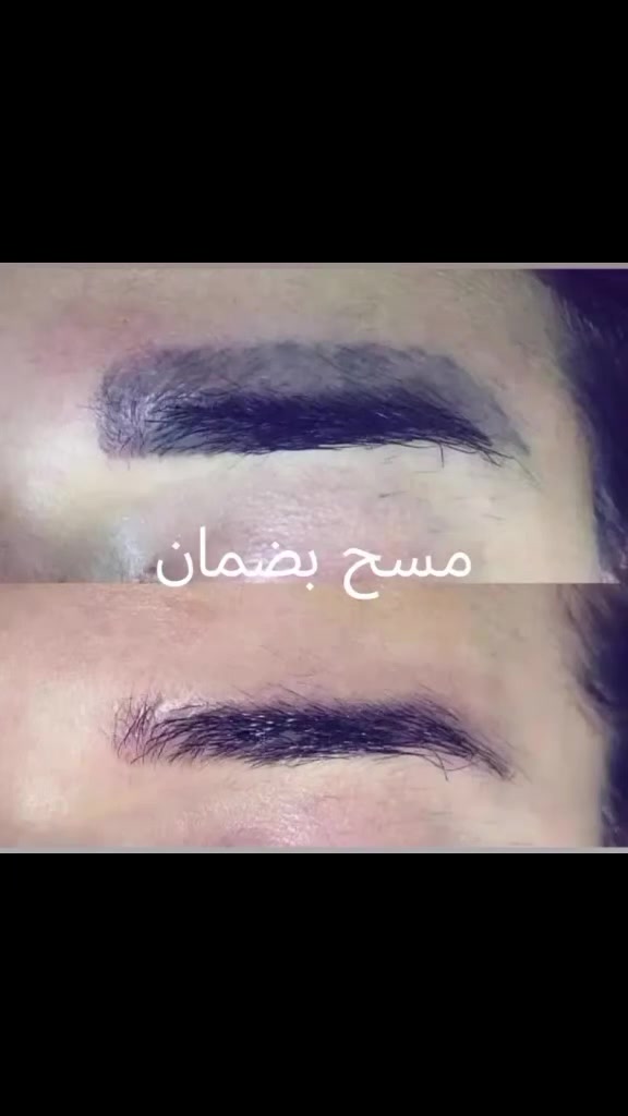 السلام عليكم
شباب الي مقدمين ع  تعين وطالبينهم للفحص وعدهم وشمات  
وفرتلكم. ازاله وشم بماده مو ليزر ماده مسح  بضمان بس الكل تعرف مو من اول جلسه 
 العنوان  بداية شارع الشريفات
رجالي محمد الحلاق يشتغللكم 
مسح وشمات   نسائي أو تاتو  صالون هدئ بيوتي يشتغللكم 
 نورونه ***********
