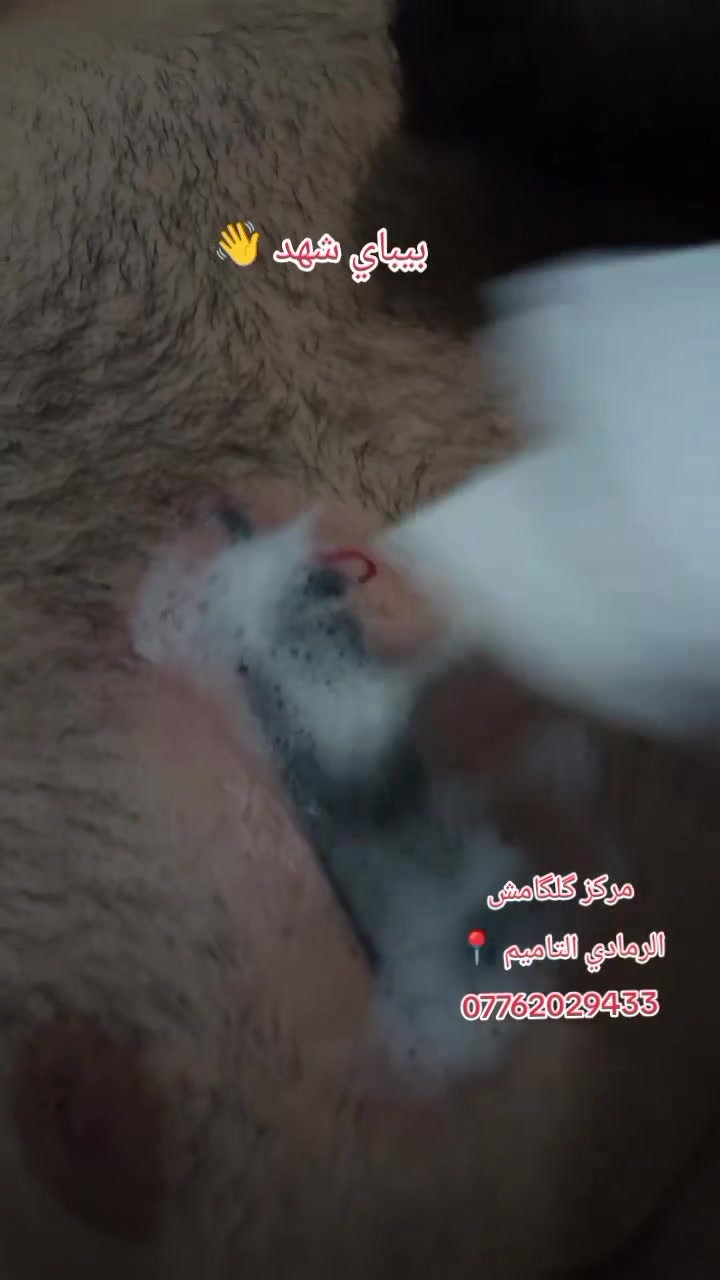 اخفاء اسم 
مركز گلگامش للوشم وازالة الوشم 
العنوان الرمادي التاميم 📍 
للاستفسار خاص وبالخدمه 🌹 
***********
***********
***********
#fyp #وشم #متابعين #مركز_گلگامش #الانبار
