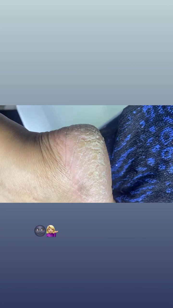 احلى العرووووض من صالون فرح بيوتي 🩷 🎀 
اوووول خمس حجوزااات الهن هدييية 🌚🎁🛍️
العنوان ، هيت حي المعلمين قرب مدرسة الانتفاضه 
متوفرة خدمة منزلية جميع مناطق هيت 🫶🏻
للحجز على الرقم او واتس ✨
*********** 
تنوروني واستقبلكم بكُل حُب 🫂🩷
