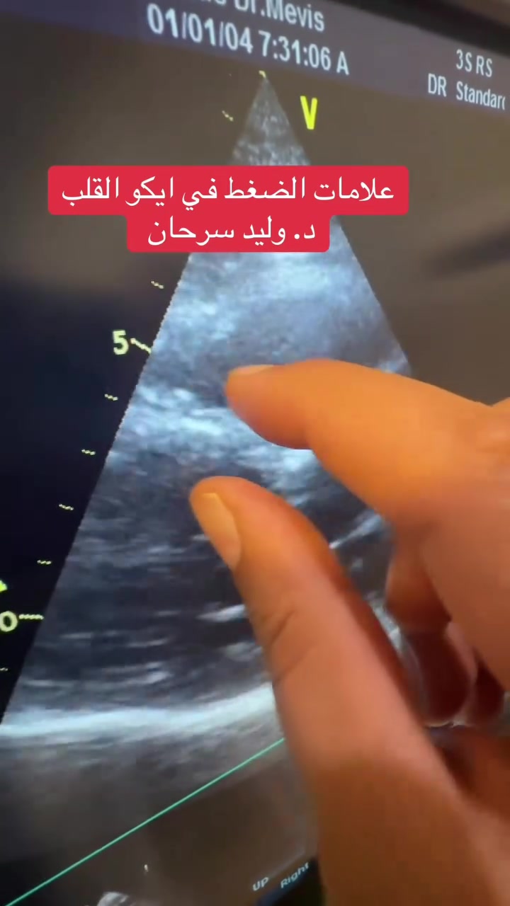 ممكن علاجه عن بعد
استشارية عن بعد بالتواصل بالوتساب من العراق او تطبيق الشفاء لمريض خارج العراق الاتصال بوتساب ٠٠٩٦٤٧٧٥٠٧٢٢٧٤٧. انا مدير اعمال الدكتور الذي يجاوبكم وليس الدكتور لانه مشغول مع الاستشارات على وتس اب وشكرا  #وليدسرحان
