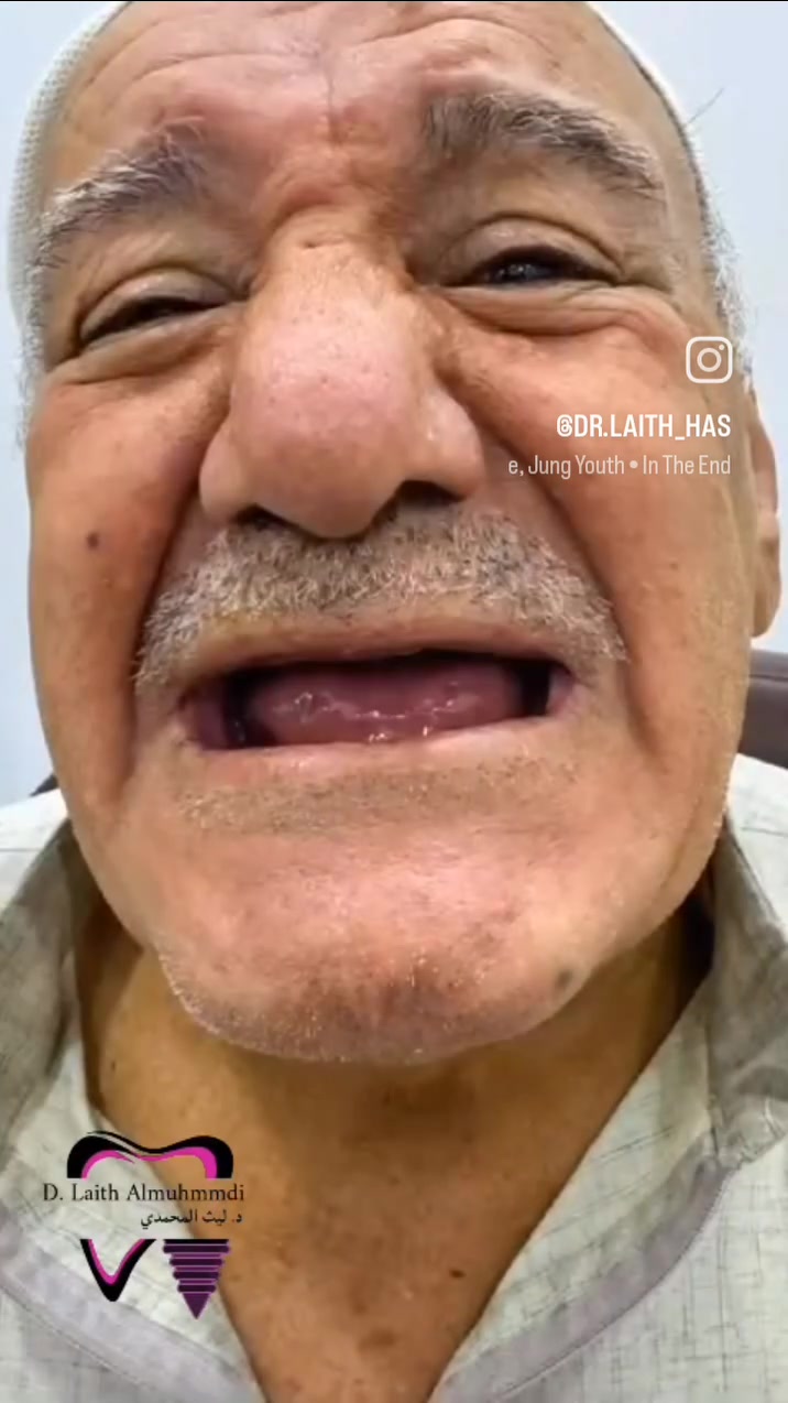 🦷✨ زراعة الأسنان… ابتسامة طبيعية وثقة من جديد!
تعاني من فقدان سن أو أكثر؟
زراعة الأسنان تساعدك على تعويض الأسنان المفقودة واستعادة وظيفة المضغ وشكل الابتسامة 🌟

🔹 زراعة الأسنان
🔹 تعويض الأسنان المفقودة
🔹 زراعة الفك الكامل
🔹 نتائج طبيعية ومظهر جمالي
🔹 إمكانية التقسيط 💳

📍 العنوان: الجغيفي الثانية – قرب الصيدلية المركزية – مقابل قاعة الجوهرة
📞 للحجز والاستفسار: ***********

✨ لا تخلي الأسنان المفقودة تمنعك من الابتسامة… احجز موعدك الآن!
