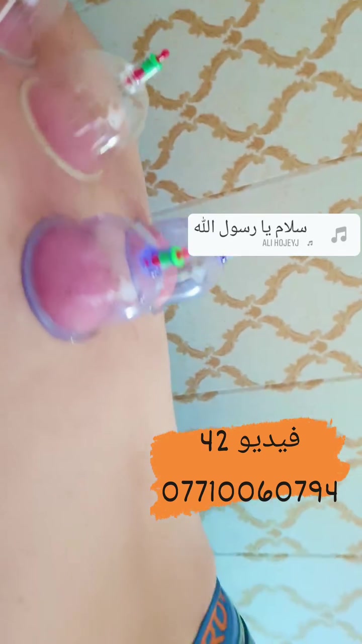 (فيديو جلسة حجامة) 42
العنوان بغداد_الكرخ الجعيفر_شارع الشيخ معروف قرب جامع رشيد دراغ
الحجز او الاستفسار ***********
 #طب_تكميلي #حجامة_رياضية #حجامةالطائي #مركزحجامةالكرخ
