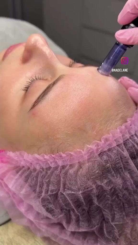 ليزر • تنظيف بشرة • جلولاء