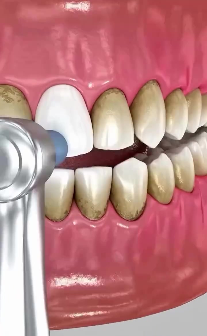 علاج اسنان مجاني • عيادات المشرق • حشوات جذور