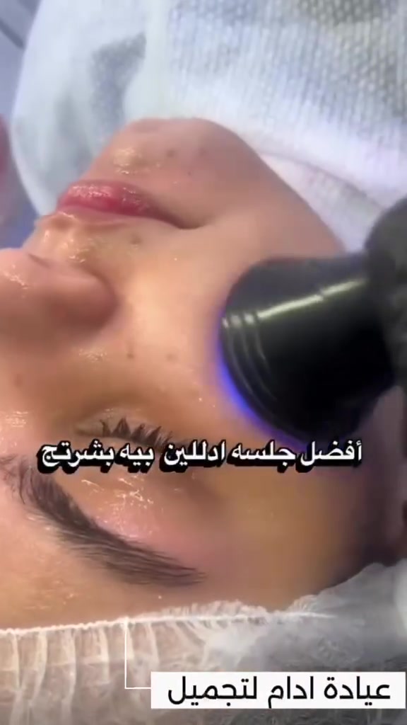 #عرض_ليوم_الجمعه_والسبت🥰💜 تنضيف البشرة العميق+بلازما مفعلة+ تنضيف الاسنان ازالة التكلسات والتصبغات وجلي الاسنان وبوليش فقط 30 الف🥰🎁الدلال بعيادتنا وبس💚😍واذا اجيتوووو شخصين دلال راح يكون اكثر وهدايا👈🎁
#للحجز والاستفسار الاتصال ع الرقم او مراسلة واتساب ***********
#العنوان حي الجزائر مقابل فندق برج الامراء عيادة ادم لطب الاسنان والتجميل
