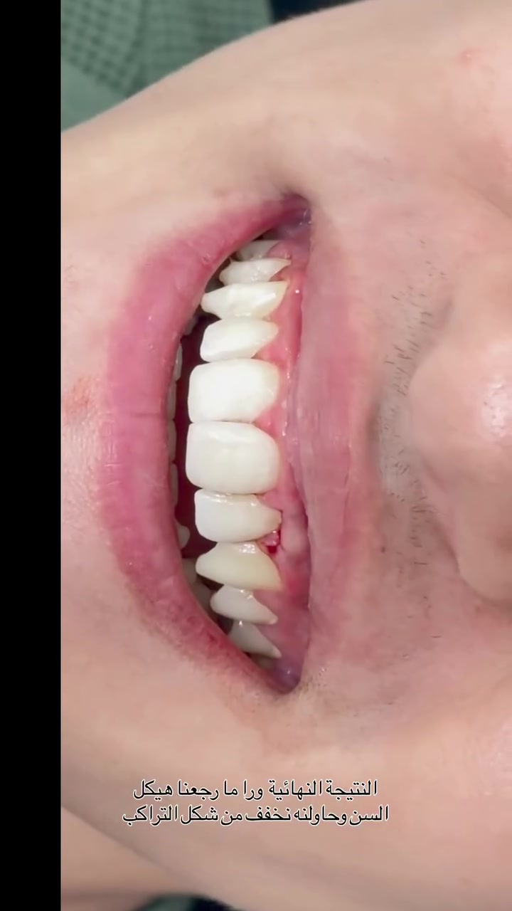 ننتضركم يوميا في عيادة كنز الابتسامه من الساعه ٥ للساعه ٩ مساءا للحجز والاستفسار واتس *********** عنوان العيادة نزلة گميره فوق صيدليه ليث صباح مقابل علوة ابو محمد
