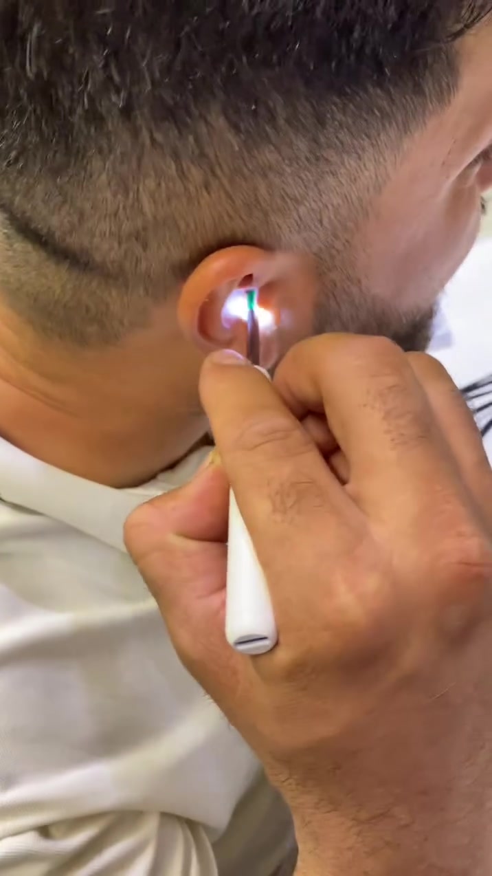 منظف الأذن الذكي بالكاميرا NK3 – Wireless Visual Earpick

• جهاز تنظيف أذن ذكي مزوّد بكاميرا يعرض صورة داخل الأذن مباشرة على الهاتف عبر الاتصال اللاسلكي، لتتمكن من تنظيف الأذن بدقة ومتابعة العملية عبر التطبيق.

• عرض مباشر على الهاتف
يعرض صورة داخل الأذن عبر تطبيق الهاتف باستخدام اتصال WiFi، ويعمل مع أجهزة Android و iOS.

• كاميرا بدقة HD
مزود بكاميرا مع مستشعر صورة CMOS لعرض صورة واضحة أثناء الاستخدام.

• اتصال لاسلكي عبر التطبيق
يتم التحكم وعرض الصورة عبر تطبيق HND بعد الاتصال بشبكة WiFi الخاصة بالجهاز.

• تصميم قابل للشحن Type-C
بطارية مدمجة قابلة للشحن بسعة 130mAh مع شحن عبر Type-C.

• حساس جاذبية ثلاثي المحاور
مزوّد بـ 3-Axis Gravity Sensor للمساعدة في استقرار الصورة أثناء الاستخدام.

 • السلسلة: NK3 Series
 • معيار الشبكة: IEEE 802.11 b/g/n
 • التردد: 2.4GHz
 • سرعة نقل الصورة: 30fps
 • مستشعر الصورة: CMOS
 • جودة الصورة: HD
 • القطر الداخلي للعدسة: 3.6mm
 • البعد البؤري: 15mm – 20mm
 • البطارية: 130mAh
 • وقت العمل: حوالي 35 دقيقة
 • وقت الشحن: حوالي 60 دقيقة
 • مدخل الشحن: DC 5V / 150mA
 • نوع الهوائي: مدمج
 • درجة حرارة التشغيل: ‎-10°C إلى ‎50°C
 • المستشعر: Gravity Sensor ثلاثي المحاور
 • الشحن: Type-C
 • الاتصال: Wireless WiFi
 • متوافق مع: Android / iOS

محتويات العلبة:
 • جهاز تنظيف الأذن بالكاميرا
 • كتيب المستخدم (User Manual)
السعر :  22000الف والتوصيل مجاني لجميع المحافظات 
سارع بالحجز عن طريق الواتساب ‏أو مراسلة الصفحة
‪***********
 #متجر
