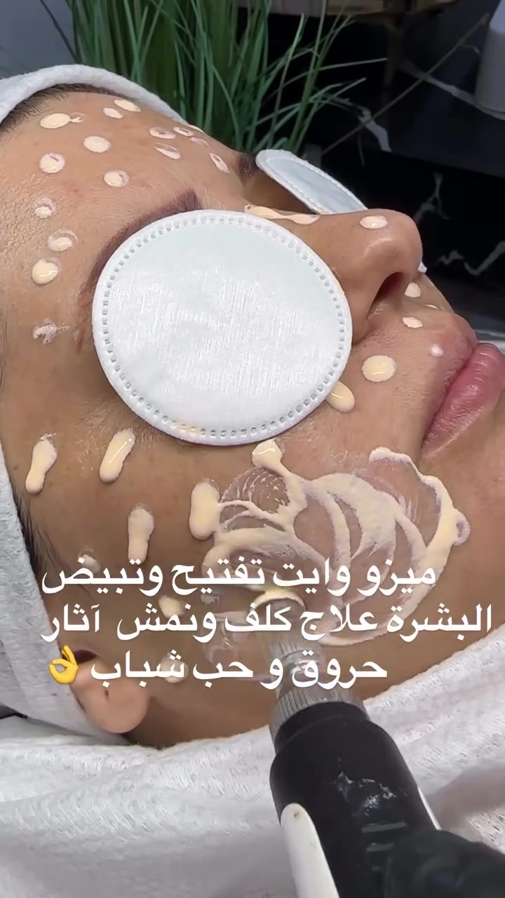 ميزووايت#تفتيح#وتبيض البشرة #***********😘🦋🦋 ##
