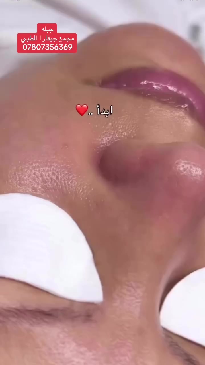 ✨ عندج مناسبة؟ خطوبة؟ عرس؟ 💍✨
خلي بشرتج تكون بأجمل إطلالة 🤍

💎 تنظيف ونضارة البشرة بجهاز الـ HydraFacial
نتيجة منعشة ولمعة حلوة للبشرة ✨
بإشراف كادر طبي مختص في مجمع جيفارا الطبي 🩺

📍 جبلة – شارع الأطباء – مقابل عيادة الدكتور حميد الزيدي
📞 للحجز والاستفسار: ***********

#مجمع_جيفارا_الطبي #هايدرفيشل #HydraFacial #تنظيف_البشرة #نضارة_البشرة #العناية_بالبشرة #جبلة #بابل #ليزر #جمال
