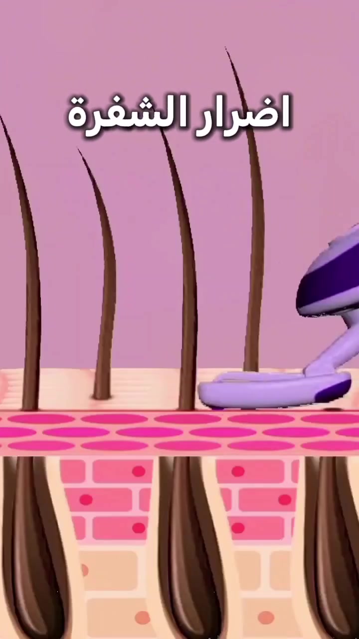 جلسة ليزر بجهاز كانديلا الثلجي بدون الم ولا حرقان والنتائج من اول جلسة تبيض درجة ونص يم نعومه بيوتي وداعاً للشعر 😉🤍🩵
