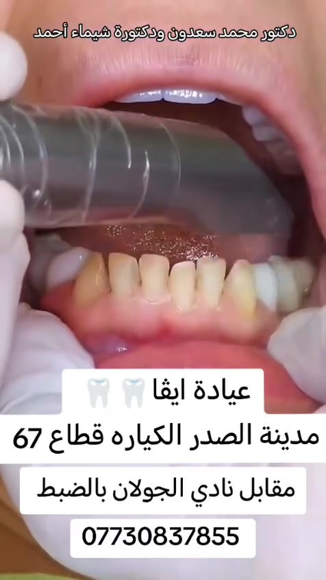 حشوه ضوئية تجميليه ب25 ألف
75 ألف تركيب الزاركون الألماني المدمج بالايماكس 
55 ألف تركيب السيراميك الألماني 
تقويم الاسنان بالتقسيط المريح 
زراعة الأسنان 

فحص ومعاينة مجاني يوميا مع اشعه للاسنان ☺️

عيادة ايفا للتجميل والأسنان 💉🦷
دكتور محمد سعدون 

العنوان #مدينة الصدر الكياره قطاع٦٧ مقابل نادي الجولان

‏‪***********‬‏📞
