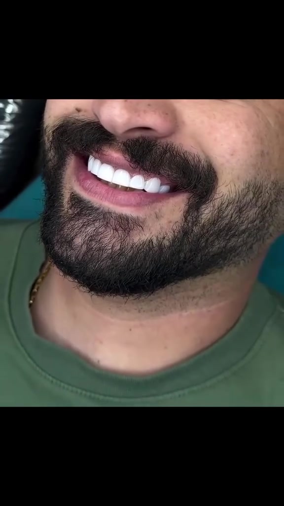 🦷✨ ابتسامة أجمل تبدأ من هنا ✨🦷

لأن جمال ابتسامتك ينعكس على ثقتك بنفسك، نقدم لكم أفضل خدمات طب الأسنان بأحدث التقنيات وأعلى معايير الجودة.

📍 مركز سما الزبير التخصصي لطب الأسنان
الزبير – محلة الشمال – شارع الشنقيطي – قرب سنتر زهير

📞 للحجز والاستفسار:
***********

💙 ابتسامتك… مسؤوليتنا، ورضاكِ غايتنا. 🌷
