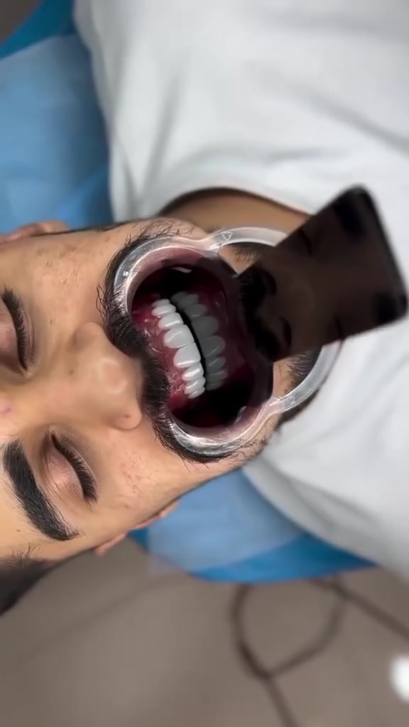 🦷✨ ابتسامة أجمل تبدأ من هنا ✨🦷

لأن جمال ابتسامتك ينعكس على ثقتك بنفسك، نقدم لكم أفضل خدمات طب الأسنان بأحدث التقنيات وأعلى معايير الجودة.

العنوان / الزبير /شارع الرشيدية/ مجاور الرشيدية سنتر

للحجز والاستفسار ***********📍 
💙 ابتسامتك… مسؤوليتنا، ورضاكِ غايتنا. 🌷🦷✨ #تقويم_اسنان #ابتسامة_هوليود #زراعة_اسنان #مراكز_الشركة_الطبية_العالمية

