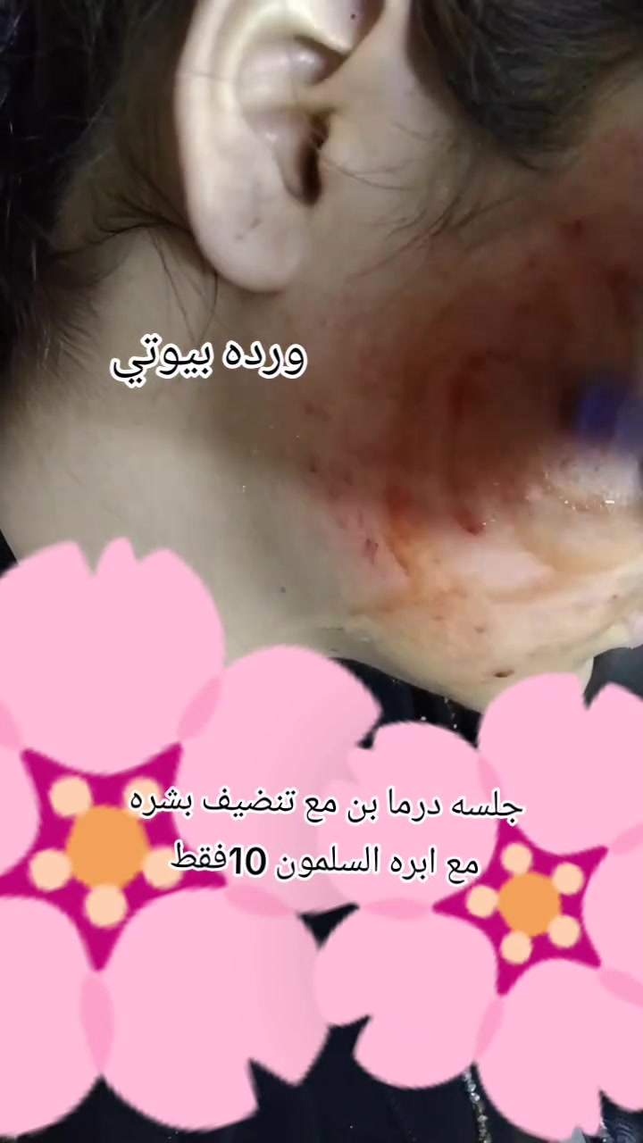 ورده بيوتي • الخطيب الزراعي • عيادات صحتي