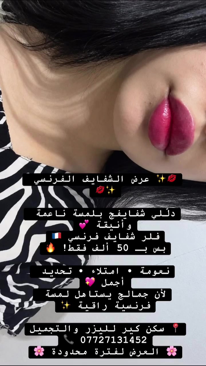 فلر شفايف • شفايف فرنسي • سكن كير