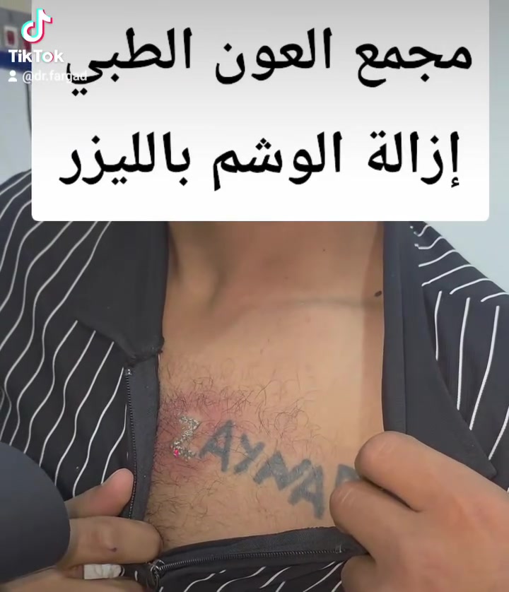 سما بيوتي • تجميل لاجراحي • بوتوكس فيلر