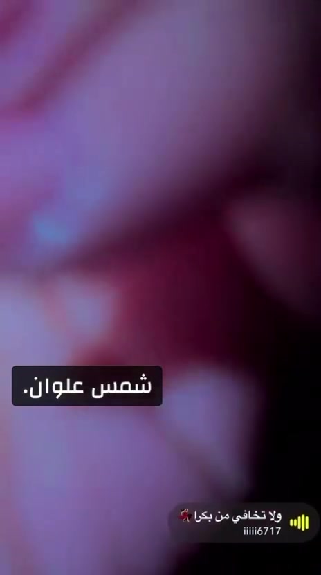 💅🏻✨ مو بس أكريلك… هذا فن وأناقة!
تفاصيل مرتبة، شغل نظيف ولمسة فخمة تخلي أظافرك تحچي عن جمالچ 🤍✨
🔥 أكريلك شمس علوان  للي تحب التميز وتريد نتيجة تفتح النفس!
📞 للحجز: ***********
