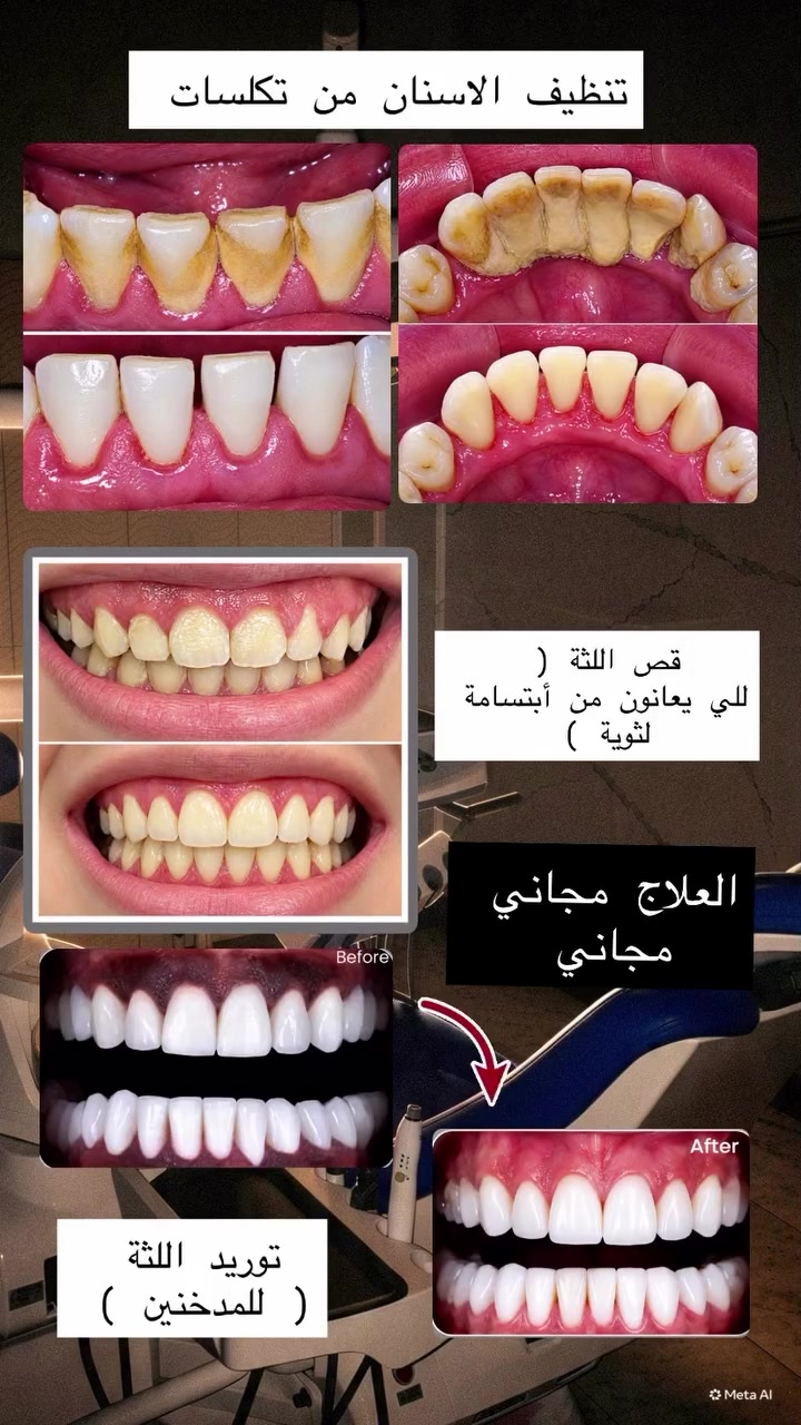 علاج اسنان مجاني • الجبيلة البصرة • عيادات الكنوز