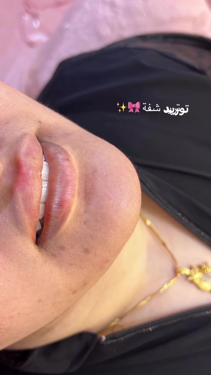 لا توجد تفاصيل
