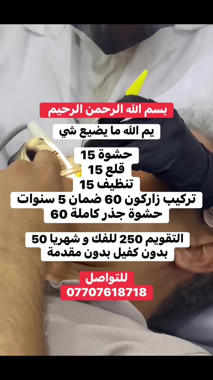 اهلي و حبايبي
راسل و تدلل لا تشيل هم الفلوس
.
.
.
.
.
.
.
.
.
.
.
.
.
.
#اسنان #عيادة

