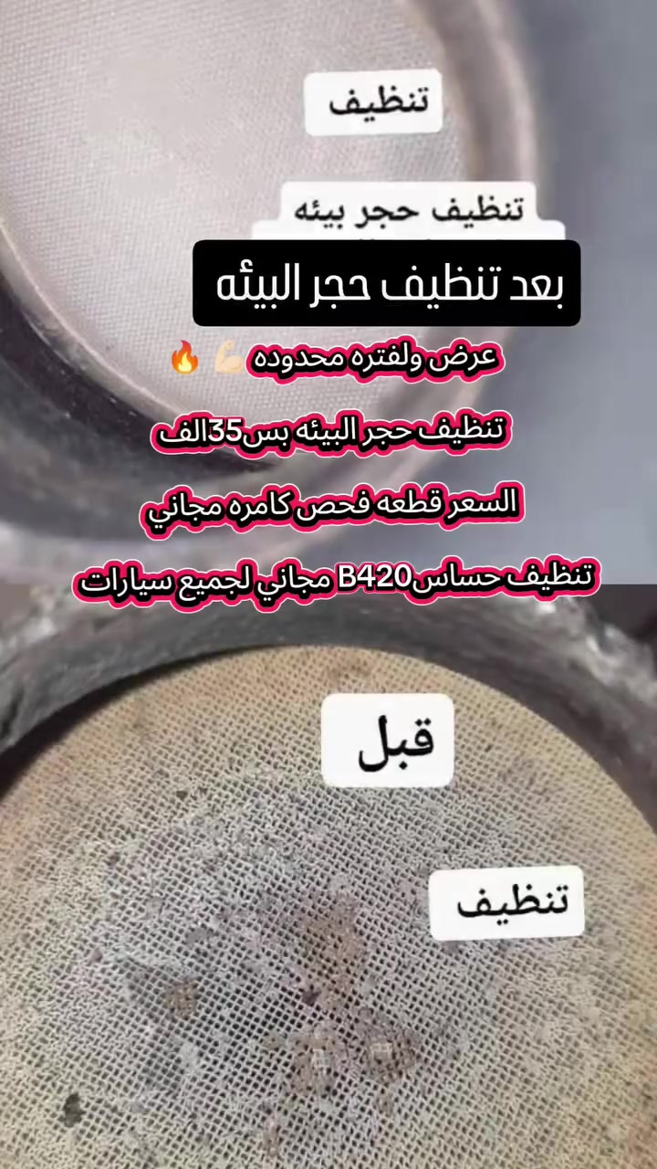 عرض ولفتره محدوده 💪🏻 السعر مفاجئة🔥بس35الف تنظيف قطعة وحده
العنوان فرع الثاني 2 بغداد الشعب شارع أسواق المركزية حي التجار قرب أسواق الوردة قرب كلية امام كاظم مقابيل محطة لؤلؤة غسل السيارات موجود الكادر حسين الكردي من 8الصبح الي 4 العصر رقم الهاتف *********** وتساب تفاصيل

 #جارجر #جارجرات_العراق #جارجرات_العراق_الفخامه_المتعه #رام #فورت #اكسبلور #تعليقاتكم
