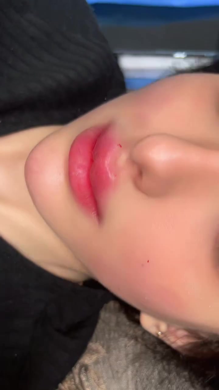 مراجعتي الحلوه
دكتورة هبة للحقن التجميلي للتواصل عبر الرقم ***********
