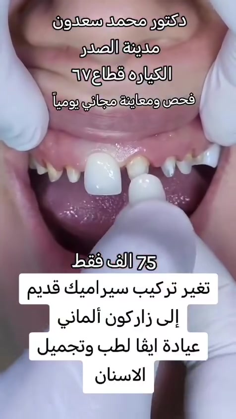 عيادة ايفا للتجميل والأسنان 💉🦷
العنوان #مدينة الصدر الكياره قطاع٦٧ مقابل نادي الجولان

‏‪***********‬‏📞
#اكبلور_العراق_السعوديه_الاردن_ايران_الكويت_طق_لايك_ات_كومنت_يلاا💜_فولو_بغداد_ميوزكلي_ #مدينة #فلر_شفايف #مدينةالصدر
