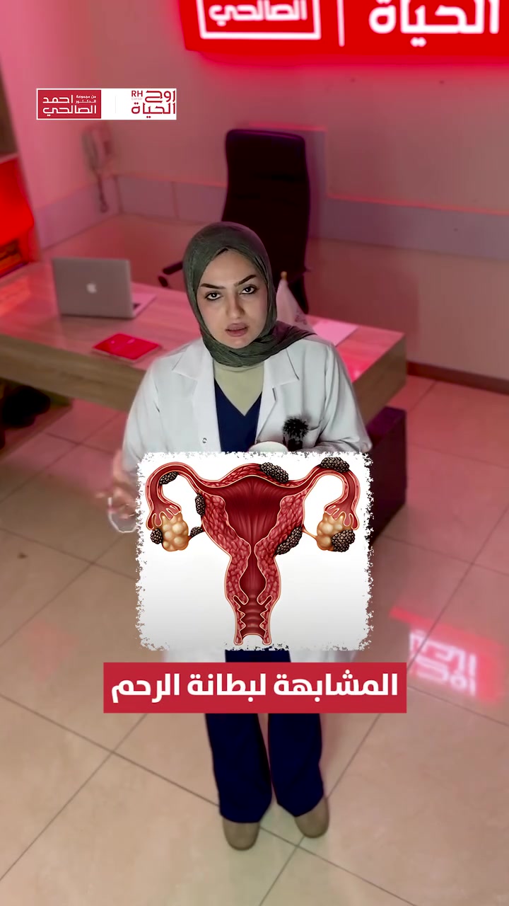 ما هي بطانة الرحم المهاجرة ؟
تابعوا الفيديو لمعلومات اكثر........📲

صحتكِ ونجاح حملكِ هما نجاحنا مع مركز روح الحياة، لا يوجد مستحيل 
━━━━━━━━━━━━━━━
 للتواصل وحجز المواعيد:
  اربيل : *********** /***********
 بغداد: *********** | ***********
 موصل : ***********
 الانبار : ***********

العناوين:
 بغداد: العطيفية - مقابل المحكمة الاتحادية
 أربيل: شارع 30 م - قرب القنصلية الإيرانية
 الموصل: حي المصارف - قرب جامع الشهيد مازن
 الأنبار: الرمادي - الشارع العام - بداية شارع ميسلون - مجمع برج المسك
━━━━━━━━━━━━━━━ 
 لمشاهدة قصص النجاح وأحدث فيديوهاتنا، تابعونا عبر الرابط التالي: 
 https://roohalhayat.com/links

