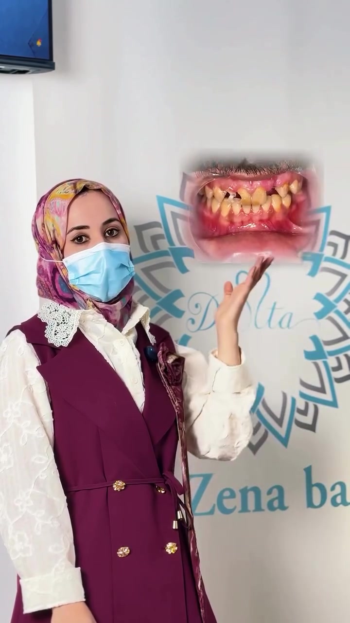"تأجل روحتك لطبيب الأسنان لأنك خايف من الألم؟
هواية من مراجعينا كانوا يحسون بنفس هذا الخوف، لكن بعيادتنا.. كسرنا هذي القاعدة!
نعتمد على أحدث الأجهزة، والتعقيم عندنا خط أحمر ما نتساهل بيه أبداً، حتى نضمن لك علاج مريح، آمن، وبدون أي ألم.
لا تخلي الوجع يسرق راحتك ويأثر على يومك.. اضغط على زر (إرسال رسالة) أسفل هذا الفيديو، واحجز موعدك حتى نرجعلك ابتسامتك وصحتك بكل ثقة."
للحجز والاستفسار 
***********
‭***********‬
موصل -حي الجامعة بالقرب من جامع بشار قلندر مقابل حي الفلاح
