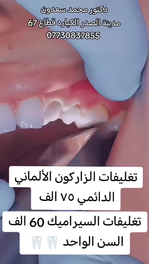 مدينة الصدر الكياره قطاع٦٧ مقابل نادي الجولان مركز ايفا الطبي
