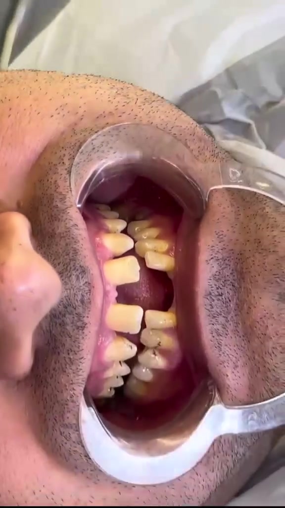"صحة فمك هي عنوان الثقة والجاذبية."

متواجدين لخدمتكم طيلة أيام الأسبوع #الشركة_الطبية_العالمية 

🔻
🏢 العنوان / بغداد _ بسماية _ الشارع العام  . مجاور ماركت الغدير 
فوق مطعم بي تاون
📲 للحجز والاستفسار 
***********
#مركز_بسماية_لطب_وتجميل_الاسنان
