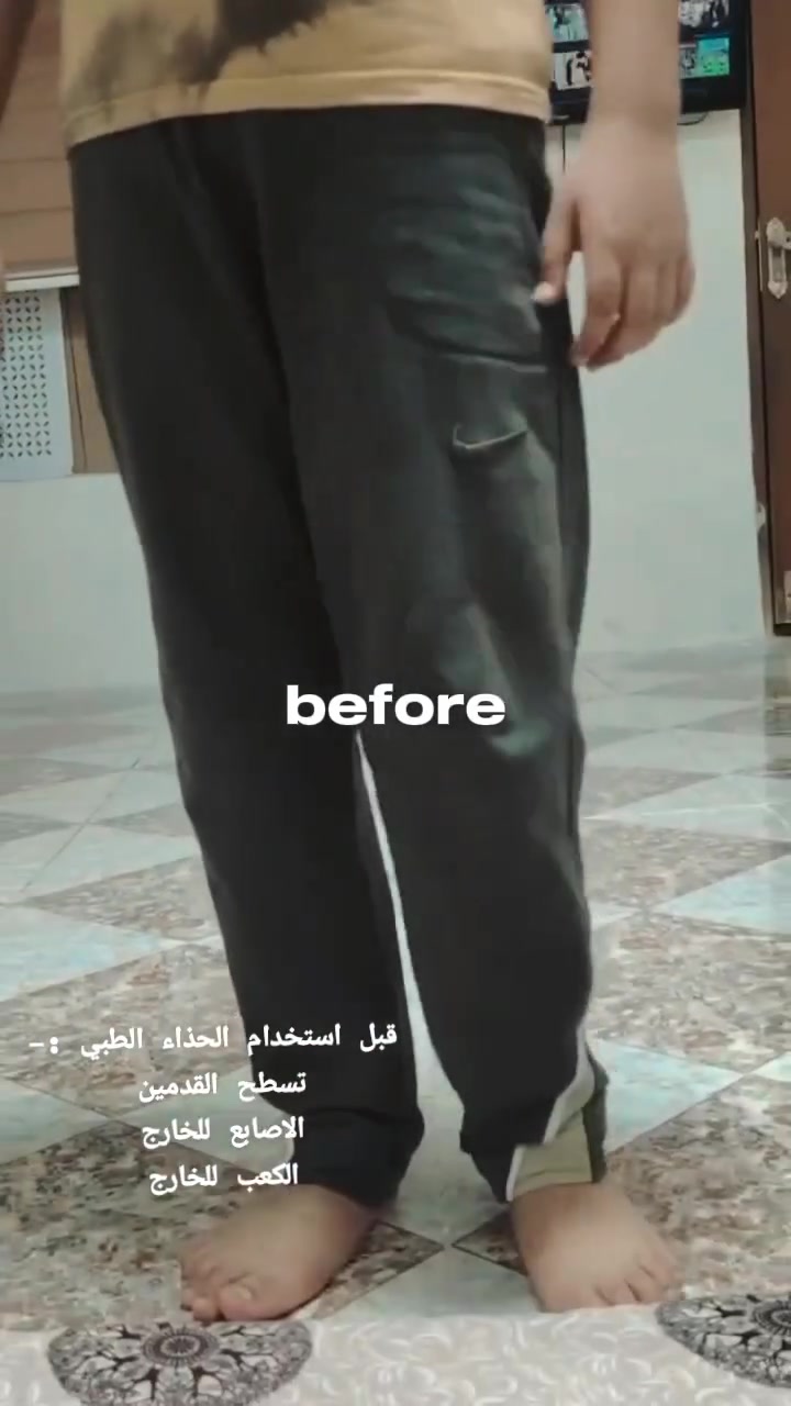 👣 من صعوبة الحركة… إلى خطوة أكثر ثباتًا ❤️
كان المريض يعاني من عدم التوازن وصعوبة في المشي، لكن مع اختيار الحذاء الطبي المناسب لحالته، بدأت خطواته تتغير نحو الأفضل. ✨
👟 أحذية طبية من أفضل المناشئ
لدعم حالات تسطح القدمين وانحراف القدمين، مع الاهتمام بالراحة والثبات أثناء الحركة.
❤️ هل لديك طفل أو شخص تعرفه يعاني من هذه الحالة؟
لا تتردد… تواصل معنا، فقد تكون الخطوة الصحيحة بداية تغيير كبير.
📞 للطلب والاستفسار:
***********
