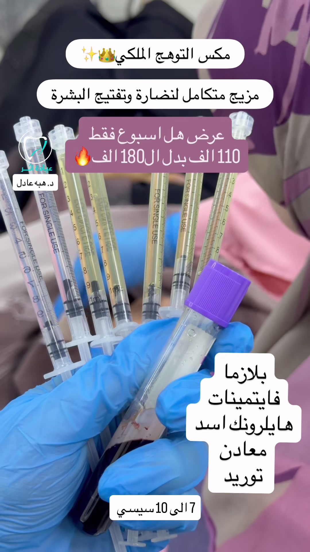 مكس التوهج الملكي 👑✨

مزيج متكامل للنضارة وتفتيح البشرة 🫧

عرض هل اسبوع فقط 110 الف بدل ال180 الف 

 عيادة اثر / د. هبه عادل 

📍كربلاء - الاسكان - مقابل مستشفى احمد الوائلي - مجمع الورد الطبي - الطابق الثاني

للحجز والاستفسار 
📞***********

#نضارة #مكس #نضارة_البشره
