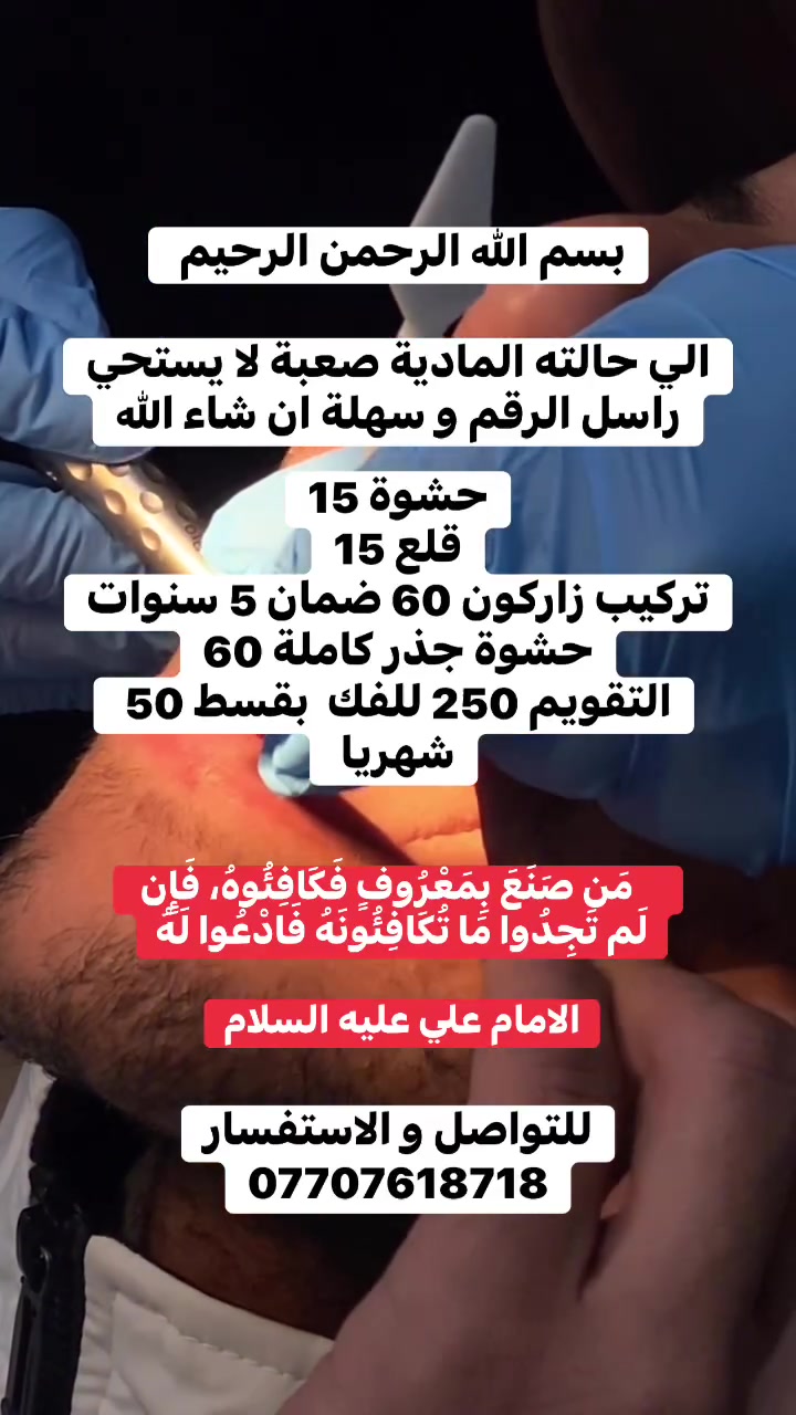 الي حالته ما تسمح راسل و سهلة ان شاء الله
.
.
.
.
.
.
.
.
.
.
.
.
.
 #اسنان #عيادة
