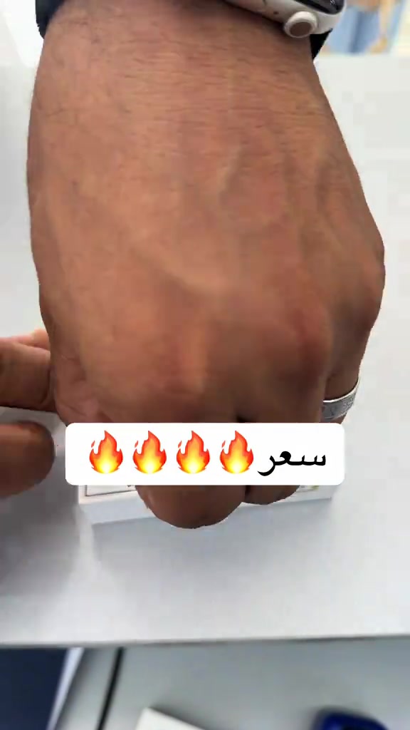 ريدمي نوت 15 • السعر بالصور
