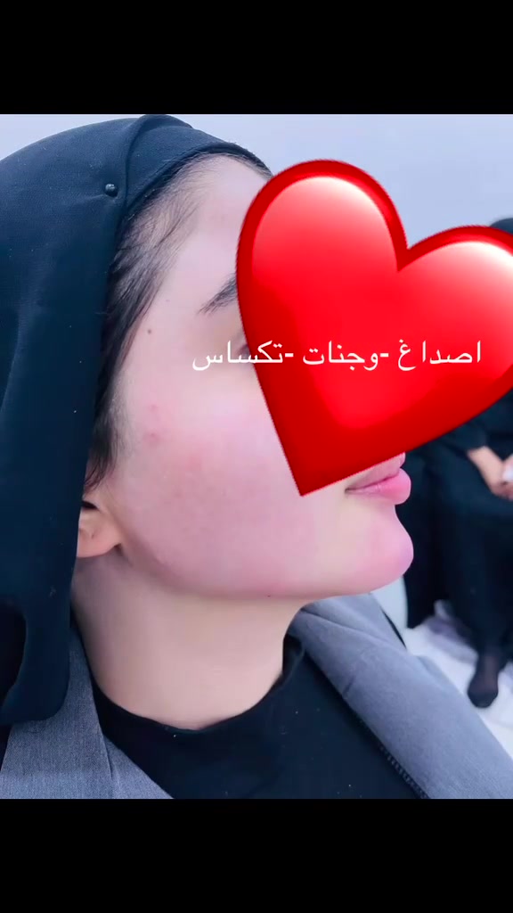 ✨ ايليا ابيوتي ✨
🎉 عرض 50% لفترة محدودة 🎉
فيلر شفه • خدود • نضارة • تكساس

بأيدي ألاخصائية ايليا 
للحجز: ***********
العنوان: بغداد - حي سومر - شارع المدارس - ظهر مستشفى الشعبي
تيك توك: frwlh2003@
