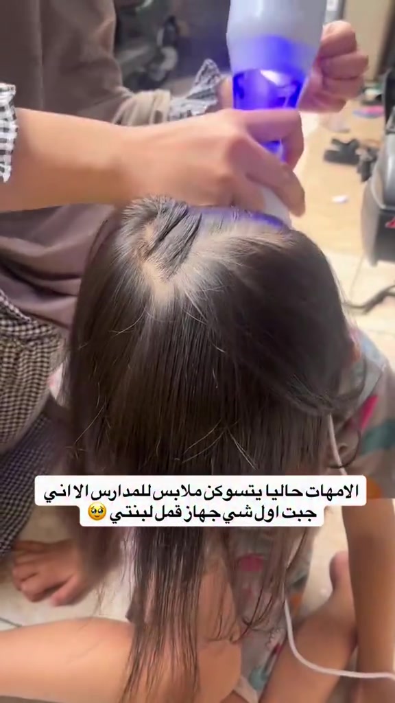 جهاز قمل الكهربائي السعر 15 الف مخصص لتمشيط الشعر مع شفط قمل الرأس والبيض أثناء الاستخدام. بعتمد الجهاز على الجمع بين التمشيط والشفط لنقل القمل والبيض إلى وحدة فلتر الالتقاط المخصصة لذلك. يحتوي على أسنان تمشيط مصنوعة من الستانستانلس ستيل بحواف مستديرة، مع إمكانية ضبط زاوية التمشيط بما يتناسب مع طريقة الاستخدام وتأتي وحدة الفلتر مزودة بإضاءة LED للمساعدة على رؤية محتويات الفلتر أثناء عملية التمشيط. يستخدم الجهاز فلتر التقاط قابلًا للاستبدال ومخصصًا للاستخدام مرة واحدة، مما يسهل التخلص من المحتويات بعد الاستخدام. يتميز بتصميم مدمج ومقبض مريح للاستخدام، ويعمل بالطاقة الكهربائية

نص مكتوب في الصور:
- الامهات حاليا يتسوكن ملابس للمدارس الا اني جبت اول شي جهاز قمل لبنتي 🥺