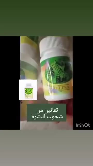 🌿💚 شنو سر سبيرولينا DXN؟ وليش كثير ناس مهتمين بيها؟
مو كل مكمل غذائي يكون غني بالعناصر الغذائية بهذا الشكل! ✨
🟢 سبيرولينا DXN تحتوي على: 💚 بروتين نباتي
💚 بيتا كاروتين
💚 كلوروفيل
💚 مركبات مضادة للأكسدة
💚 مجموعة من العناصر الغذائية
🌱 إذا تهتمين بتغذيتك وتحبين تضيفين مكمل غذائي إلى روتينك اليومي، ممكن تكون السبيرولينا خيارًا يستحق التعرف عليه.
❌ مو دواء
❌ مو بديل عن العلاج
✅ مكمل غذائي يُستخدم ضمن نظام غذائي متوازن.
📩 تحبين تعرفين شنو هي سبيرولينا DXN وكيف تُستخدم؟ اكتبي بالتعليقات: "سبيرولينا 💚" وأرسل لكِ التفاصيل.
#DXN #سبيرولينا #Spirulina #تغذية_صحية #مكملات_غذائية #العراق
للحصول على المنتج التواصل معي واتساب ***********

