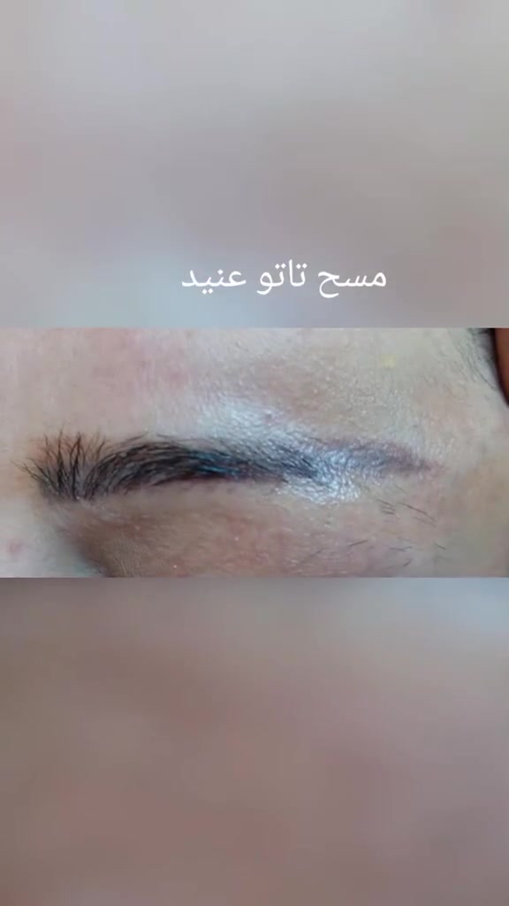 السلام عليكم
شباب الي مقدمين ع  تعين وطالبينهم للفحص وعدهم وشمات  
وفرتلكم. ازاله وشم بماده مو ليزر ماده مسح  بضمان بس الكل تعرف مو من اول جلسه 
 العنوان  بداية شارع الشريفات
رجالي محمد الحلاق يشتغللكم 
مسح وشمات   نسائي أو تاتو  صالون هدئ بيوتي يشتغللكم 
 نورونه ***********
