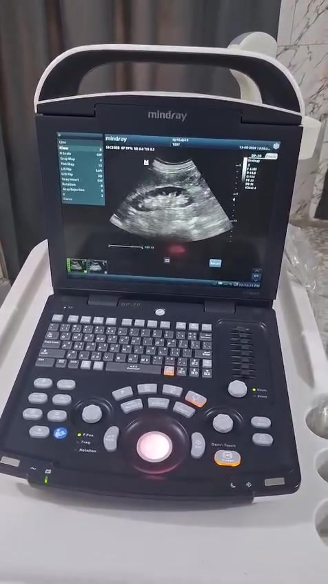 توفر جهاز سونار بورتبل ابيض واسود مع خاصية الدوبلر PW نوع Mindray DP-20 مستعمل نظيف كلش مع بروب كونفكس سنة الصنع 2022 ويمكن إضافة بروب فجاينال او لينير حسب طلب الزبون . للتواصل مراسلة الصفحة او الاتصال على الرقم *********** مهندس عماد .
#Mindray
#Chison
#سونار
